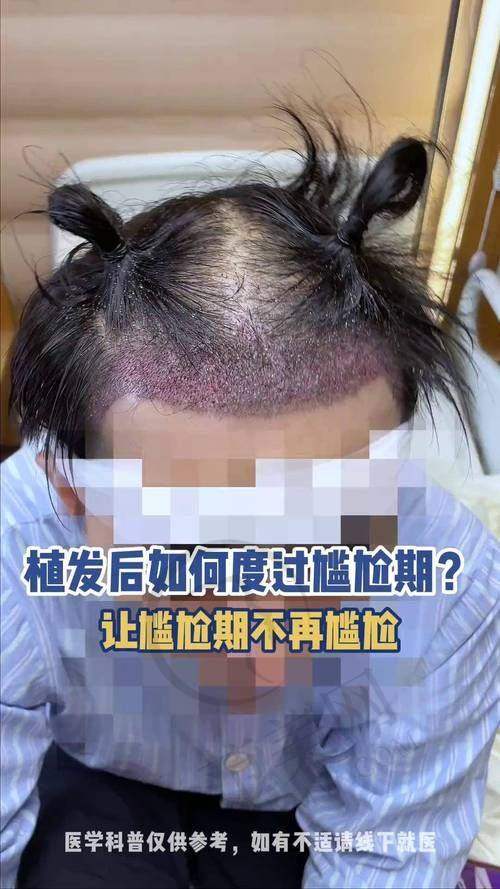赵进医生的口碑评价及反馈实例