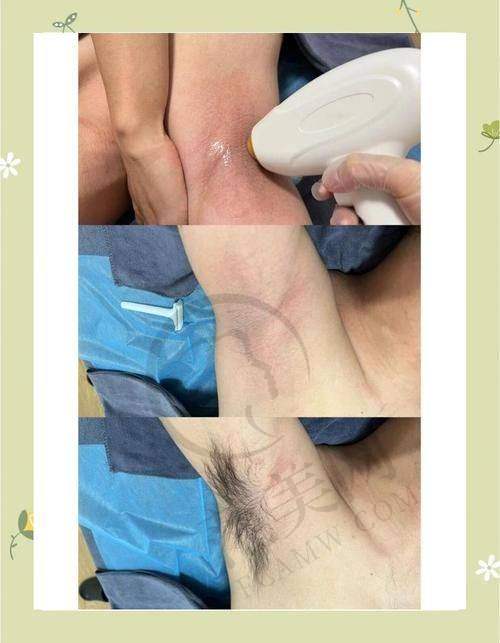赵进医生在植发领域的执医荣誉