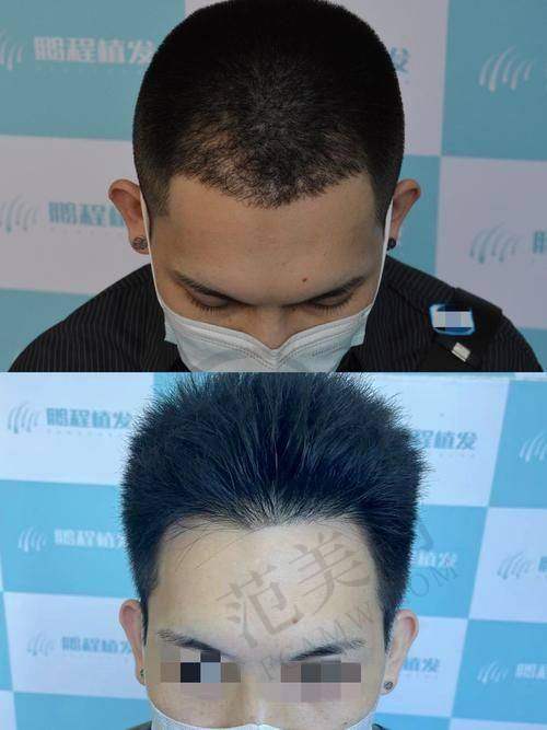 邹岩医生的口碑评价及反馈情况