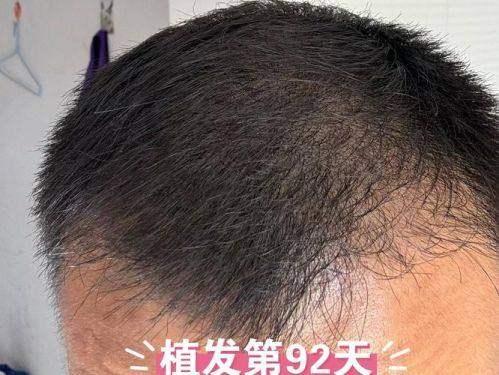 北京瑞丽诗植发医院怎么样，口碑评价如何？