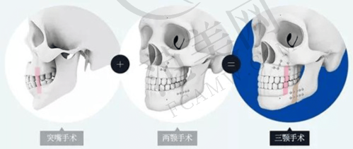 荔湾区人民医院整形科价格详情