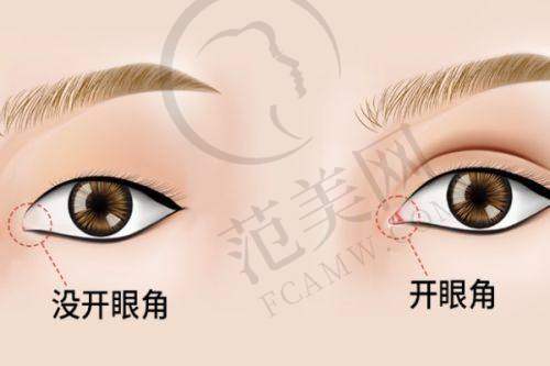 上海雅尚切眉紧致提拉眼周6993元起顾客实例