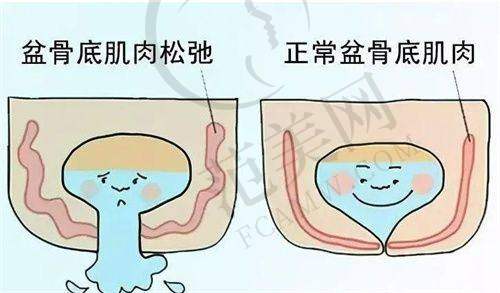 呼和浩特华美除皱瘦脸2248元起项目简介