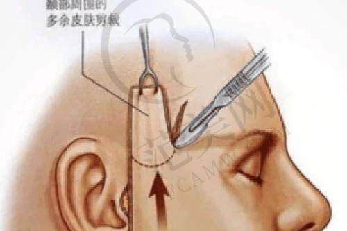 天津联合丽格手术除腋臭去狐臭6711元起项目详细介绍
