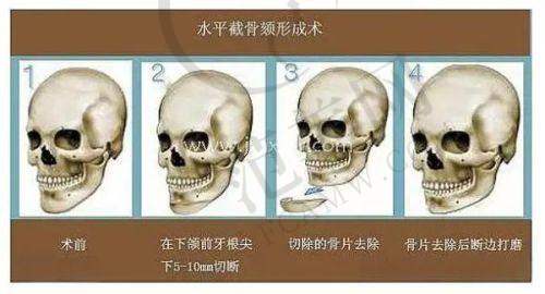 烟台洛神医疗美容医院的整形项目与价格