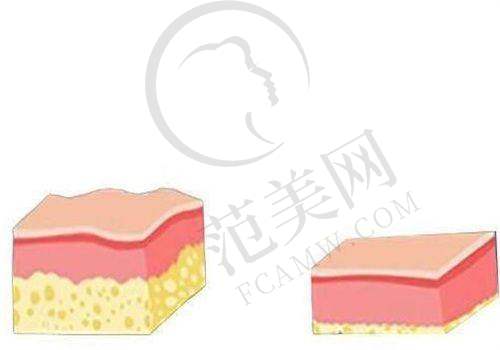 绍兴华美乳头缩小术改善8523元起医生简介