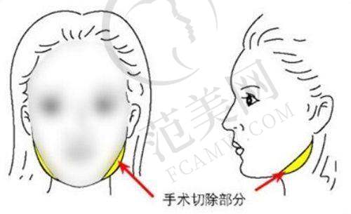 烟台洛神医疗美容医院的设备与服务特色