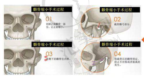 芜湖壹加壹植发美容医院医生简介
