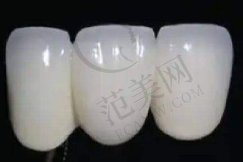 苏州英博口腔 2025 价格表一览:价格优惠活动一般在什么时候?