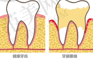 预约挂号有哪些注意事项？