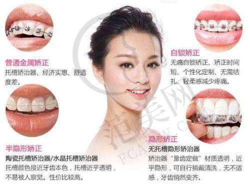 广州德伦口腔种牙收费受哪些因素影响？