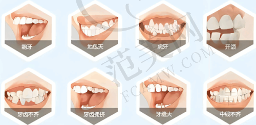 苏州英博口腔 2025 价格表一览:隐形矫正除了价格还有哪些优势?