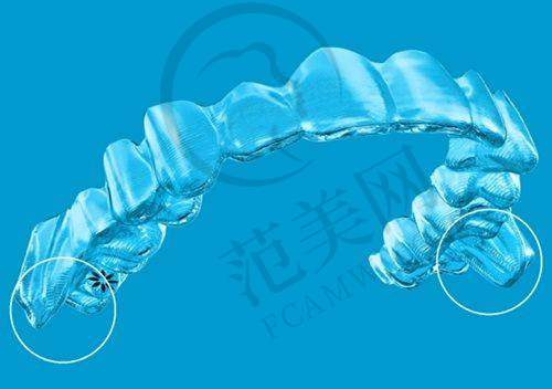 2025上海正畸私立医院推荐：正睿口腔正畸有何亮点？