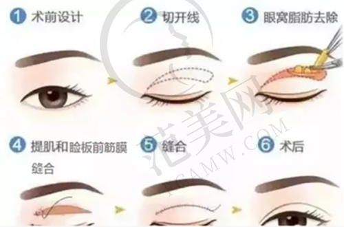 南通维多利亚瑞蓝唯瑅轮廓固定10335元起的技术保护