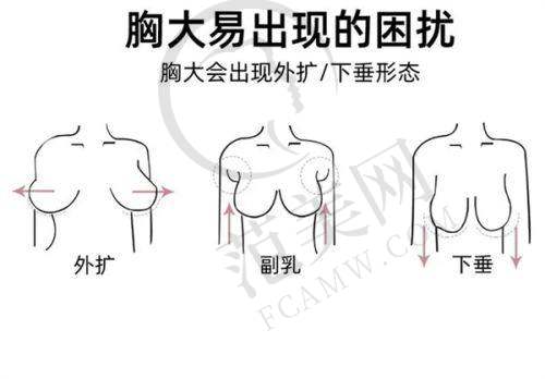 上海雅尚切眉紧致提拉眼周6993元起划算吗？