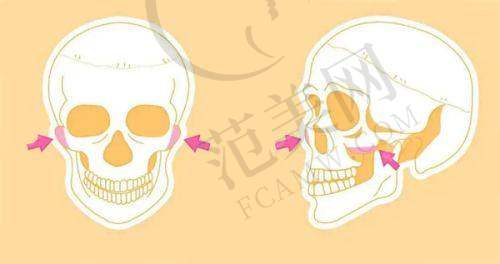 绍兴华美乳头缩小术改善8523元起优势详解