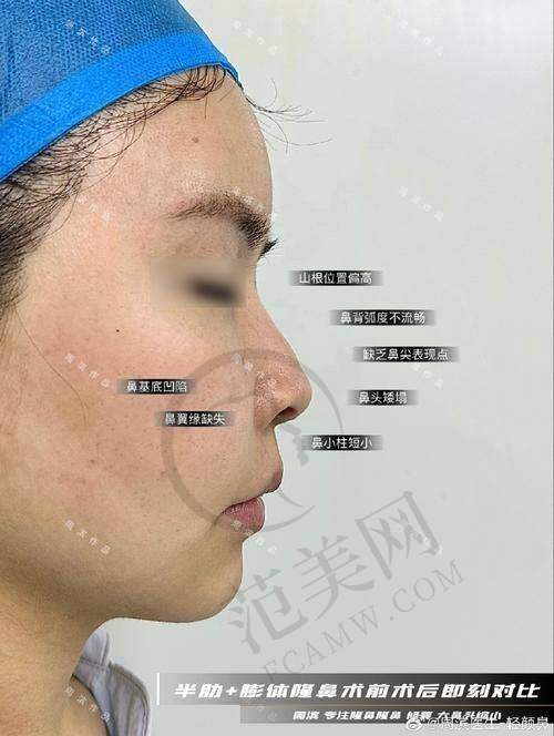 合肥壹加壹整形医院项目特色