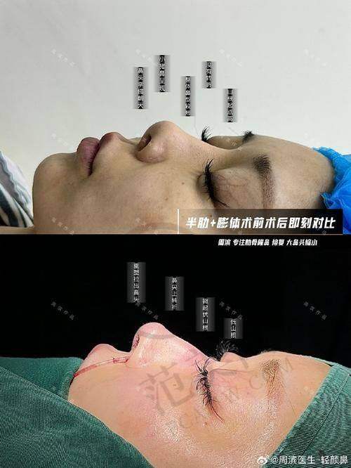 武汉壹加壹整形医院口碑好不好？附真实患者口碑评价