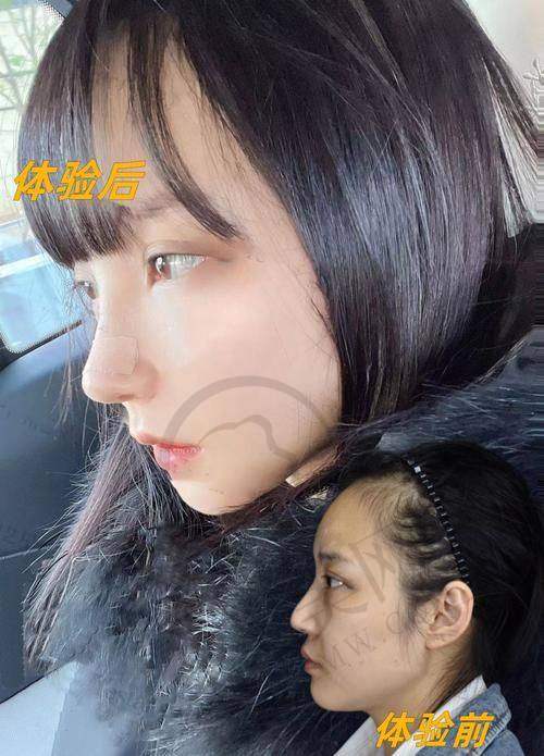 吴开泉医生擅长的整形项目