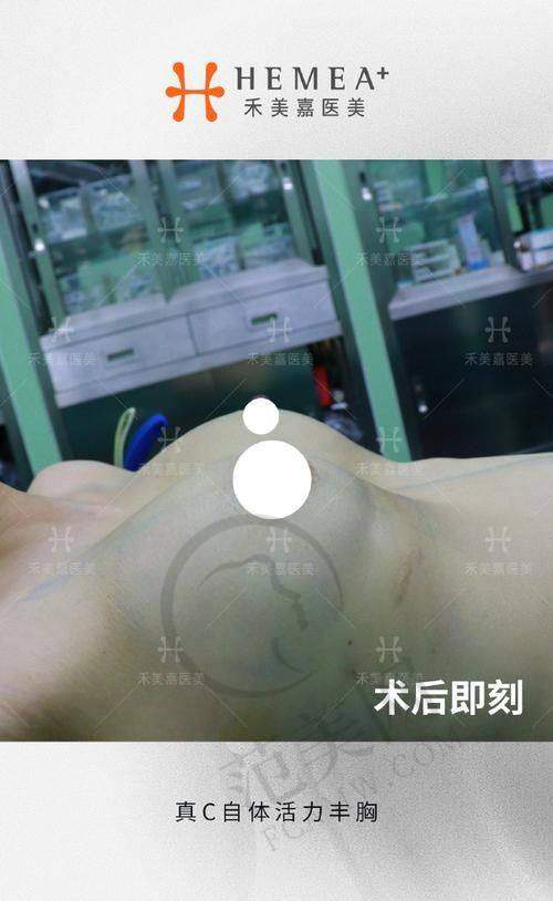 阜阳壹加壹整形美容医院价格表