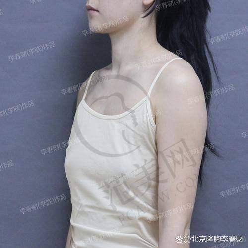 张广宇医生：鼻整形领域佼佼者