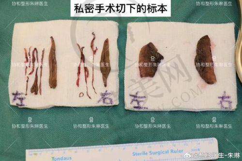 刘小娇医生的技术优势亮点
