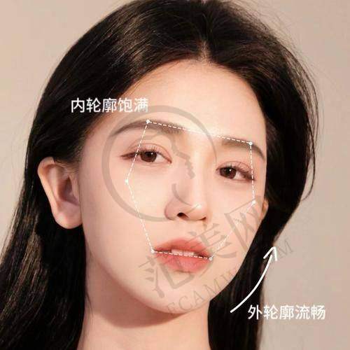 淮安华美伊婉婉美填充塑形1274元起项目简介