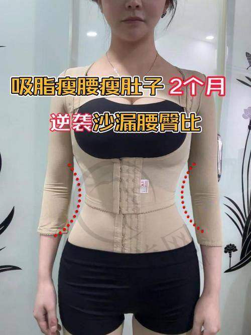绍兴华美负压腰腹吸脂7797元起项目简介