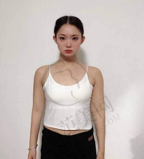绍兴华美负压腰腹吸脂7797元起划算吗