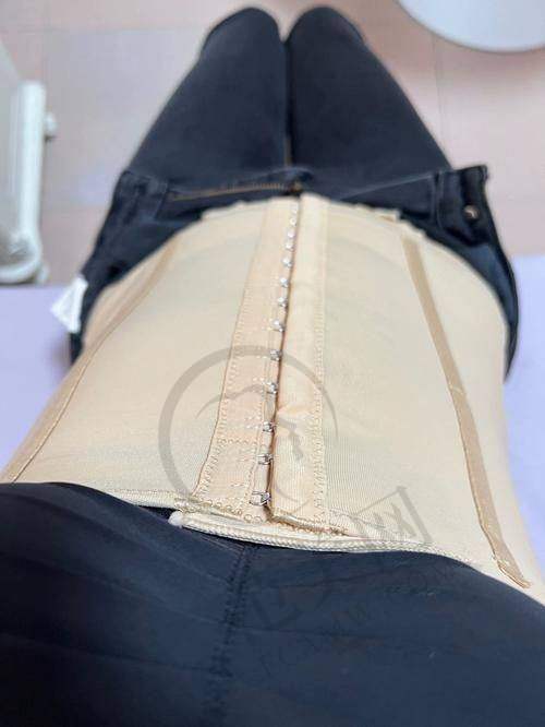 绍兴华美负压腰腹吸脂7797元起优势详解