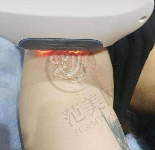 合肥壹加壹整形医院医生简介