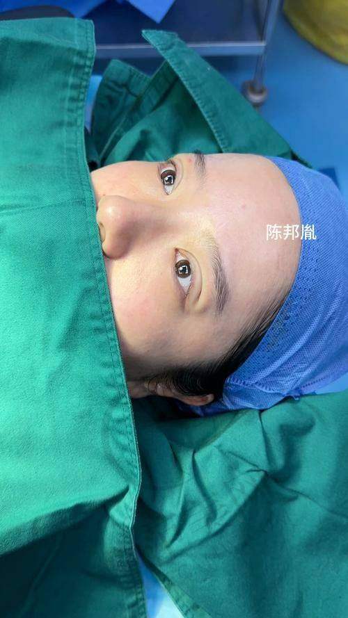 厦门海峡自体脂肪填充全脸33430元起医生简介