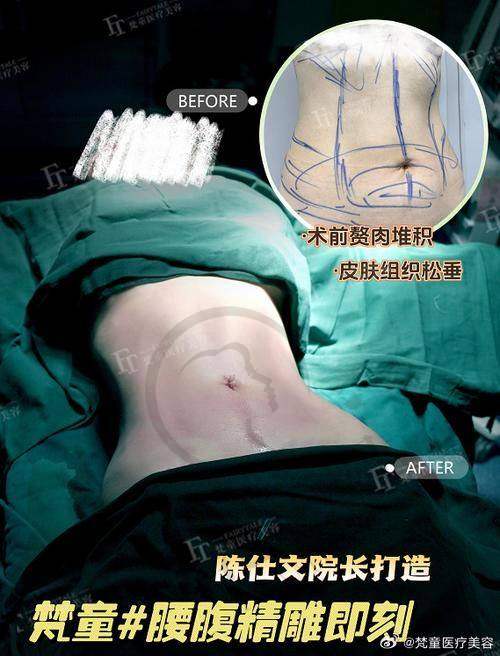 李峰医生的技术优势