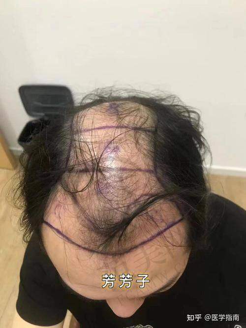 武汉壹加壹整形医院怎么样，口碑评价如何？