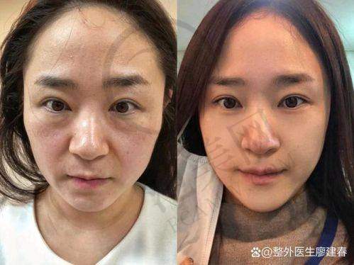 宜昌华美冭活泡泡水光393元起项目详细介绍