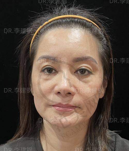 宜昌华美冭活泡泡水光393元起划算程度分析