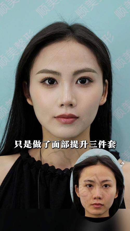 宜昌华美冭活泡泡水光393元起预约方式指南