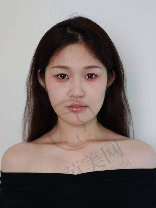 哈尔滨领艺医疗美容门诊部怎么样，口碑评价如何？