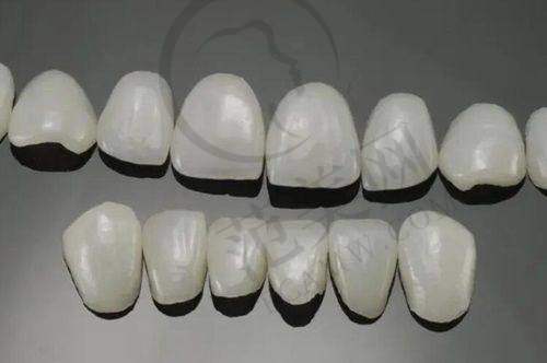 柳州中瑞口腔牙齿美白和牙冠费用如何？