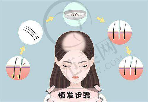 深圳曙光整形医院怎么样，口碑评价如何？