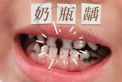 合肥比较好的牙齿矫正机构推荐之合肥壹加壹口腔