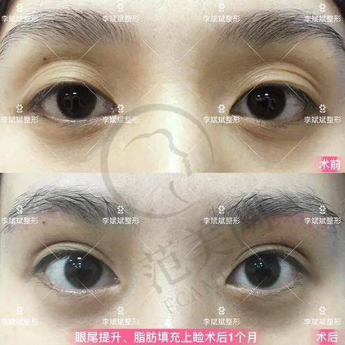 杭州鹏爱医疗美医院怎么样，口碑评价如何