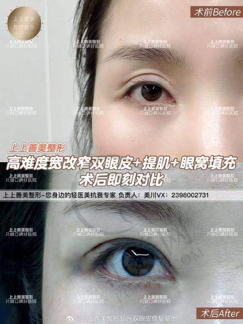海口鹏爱医疗美容医院具体地址