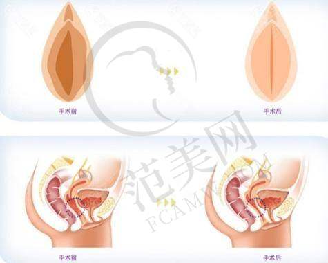 深圳曙光整形医院价格表