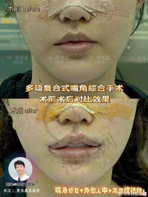成都高新米兰柏羽医学美容院抖音团购活动有哪些，价格表