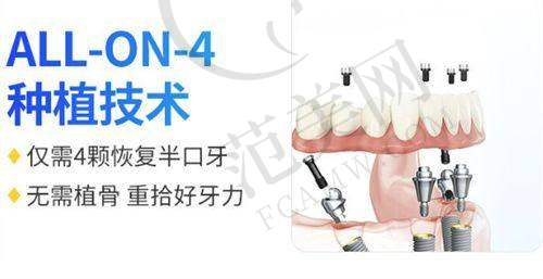 苏州吴江咿呀英博口腔门诊部擅长项目