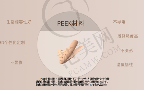 柳州植发医院排名前三位之柳州华美植发价格怎样？