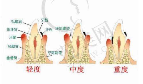 刘勤医生顾客实例图片