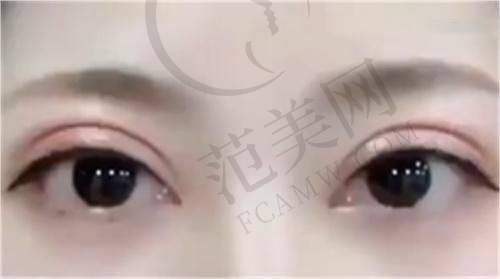 柳州植发医院排名前三位之柳州仁美植发医生咋样？