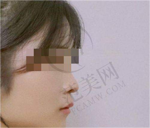 石家庄芘丽芙贵美人美容医院口碑好不好？附真实患者口碑评价